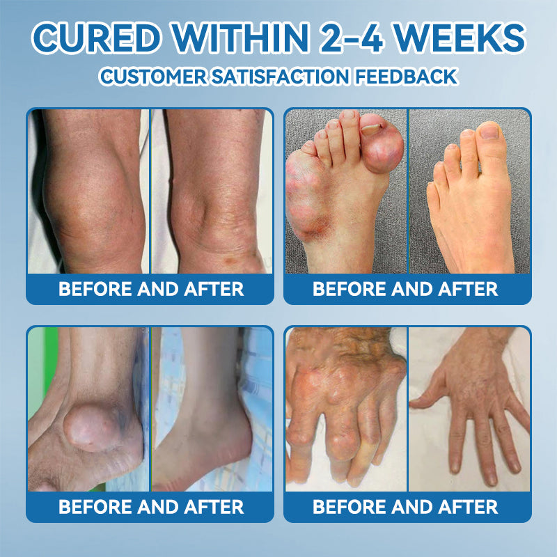 Love in Double! Buy One, Get One Free🔥﻿Tiworld® 𝐁𝐏𝐂-𝟏𝟓𝟕 𝐉𝐨𝐢𝐧𝐭 𝐇𝐞𝐚𝐥𝐢𝐧𝐠 𝐂𝐫𝐞𝐚𝐦🦴Treats Arthritis, Neuropathy, Rheumatism, Sports Injuries & More🏆