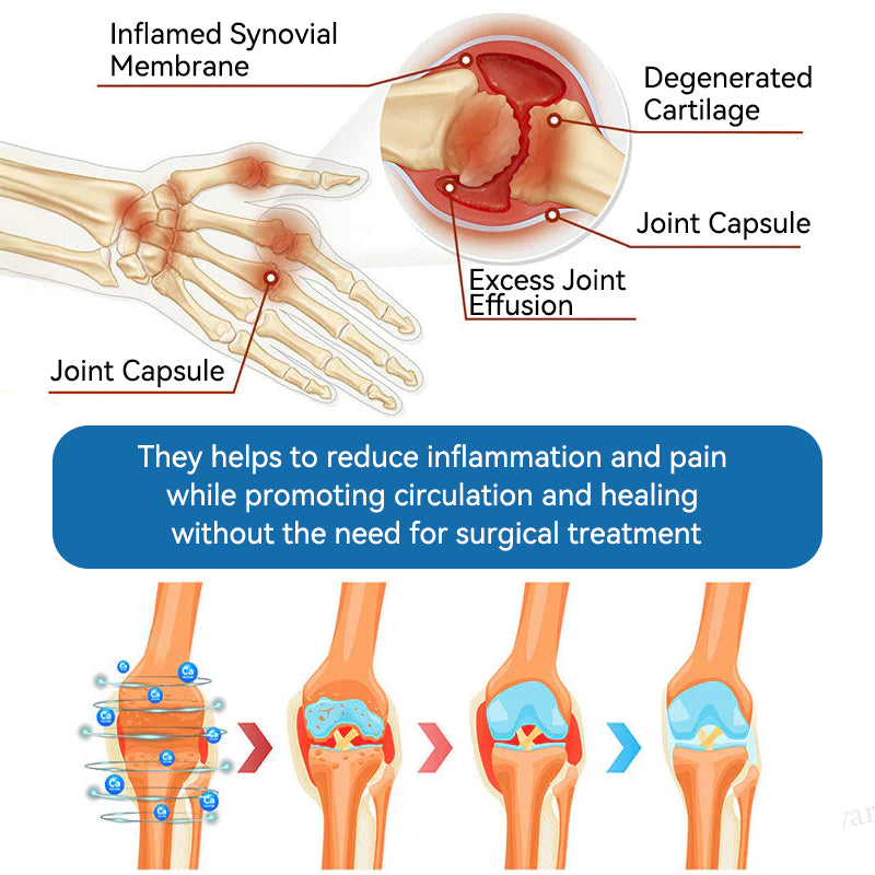 Love in Double! Buy One, Get One Free🔥﻿Tiworld® 𝐁𝐏𝐂-𝟏𝟓𝟕 𝐉𝐨𝐢𝐧𝐭 𝐇𝐞𝐚𝐥𝐢𝐧𝐠 𝐂𝐫𝐞𝐚𝐦🦴Treats Arthritis, Neuropathy, Rheumatism, Sports Injuries & More🏆