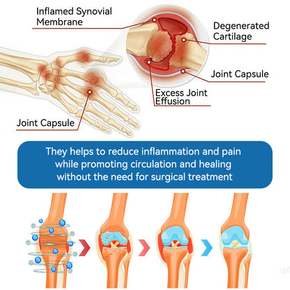 Love in Double! Buy One, Get One Free🔥﻿Tiworld® 𝐁𝐏𝐂-𝟏𝟓𝟕 𝐉𝐨𝐢𝐧𝐭 𝐇𝐞𝐚𝐥𝐢𝐧𝐠 𝐂𝐫𝐞𝐚𝐦🦴Treats Arthritis, Neuropathy, Rheumatism, Sports Injuries & More🏆