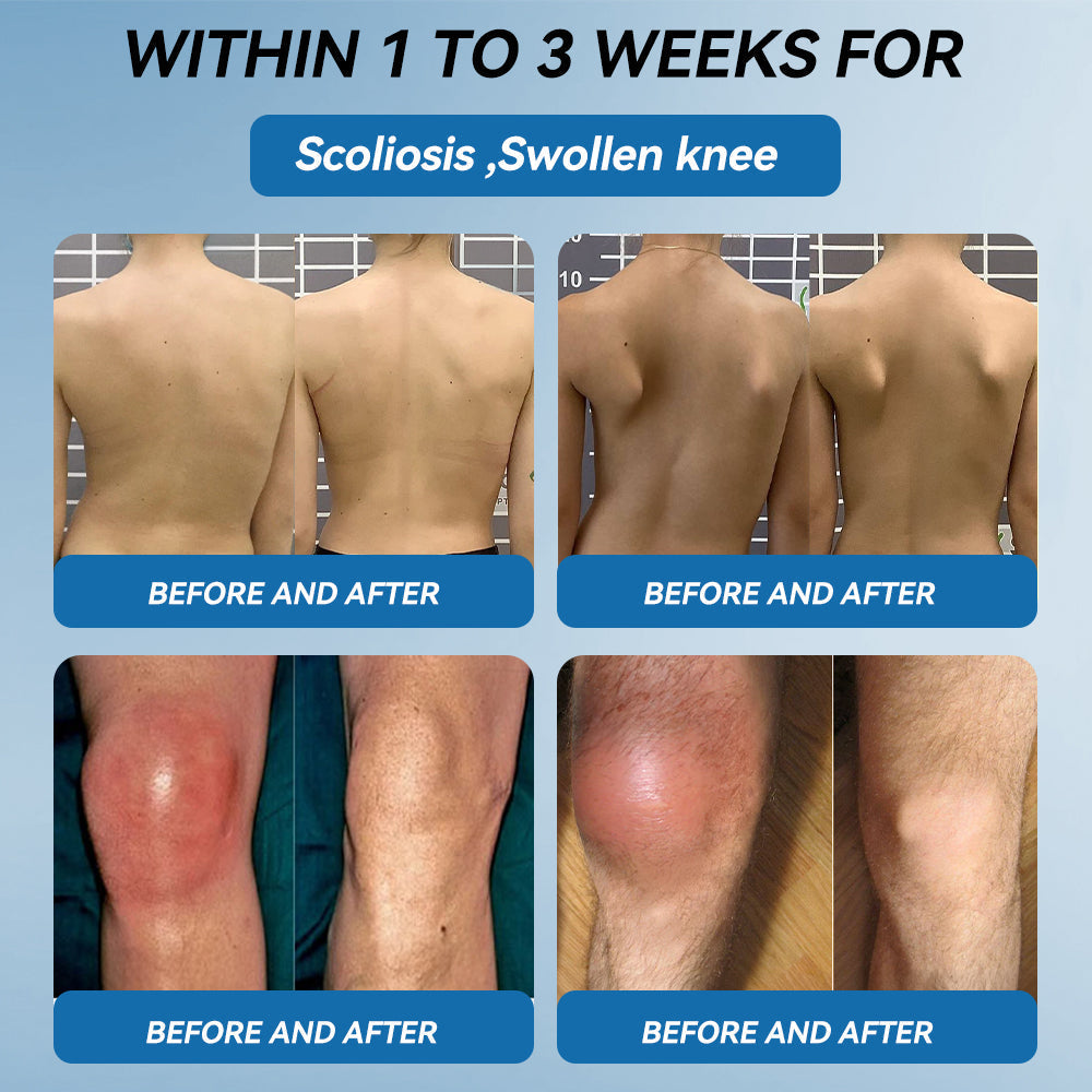 Love in Double! Buy One, Get One Free🔥﻿Tiworld® 𝐁𝐏𝐂-𝟏𝟓𝟕 𝐉𝐨𝐢𝐧𝐭 𝐇𝐞𝐚𝐥𝐢𝐧𝐠 𝐂𝐫𝐞𝐚𝐦🦴Treats Arthritis, Neuropathy, Rheumatism, Sports Injuries & More🏆