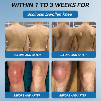 Love in Double! Buy One, Get One Free🔥﻿Tiworld® 𝐁𝐏𝐂-𝟏𝟓𝟕 𝐉𝐨𝐢𝐧𝐭 𝐇𝐞𝐚𝐥𝐢𝐧𝐠 𝐂𝐫𝐞𝐚𝐦🦴Treats Arthritis, Neuropathy, Rheumatism, Sports Injuries & More🏆