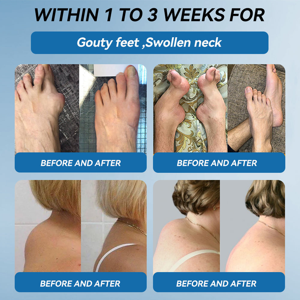 Love in Double! Buy One, Get One Free🔥﻿Tiworld® 𝐁𝐏𝐂-𝟏𝟓𝟕 𝐉𝐨𝐢𝐧𝐭 𝐇𝐞𝐚𝐥𝐢𝐧𝐠 𝐂𝐫𝐞𝐚𝐦🦴Treats Arthritis, Neuropathy, Rheumatism, Sports Injuries & More🏆